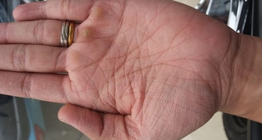 Bật mí những đường chỉ tay xấu và Cách hóa giải những đường chỉ tay không nên có 2 những đường chỉ tay xấu